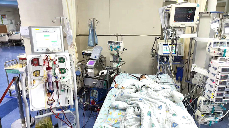 PICU里，上了ECMO+CRRT 的小依依。浙大兒院供圖